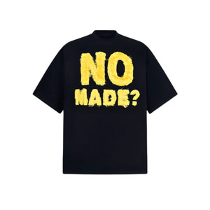 NOPE — TEE